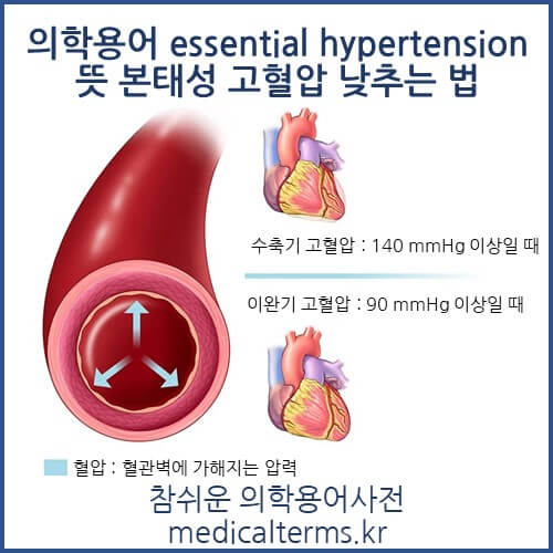 의학용어 essential hypertension 뜻 본태성 고혈압 낮추는 법, 혈압이 높아지는 이유 5가지