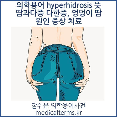 의학용어 hyperhidrosis 뜻 땀과다증 다한증, 엉덩이 땀 원인 증상 치료